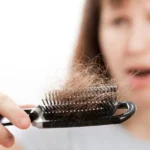 Haarausfall nach Schwangerschaft