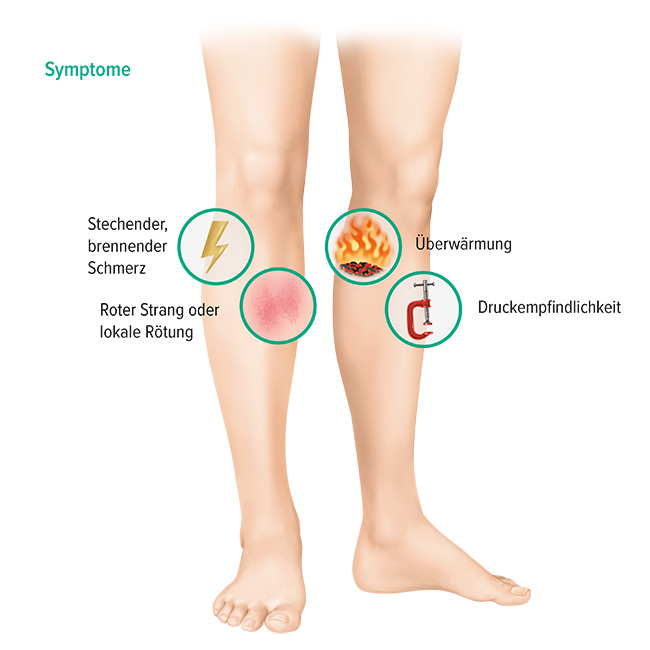 Thrombose-Selbsttest